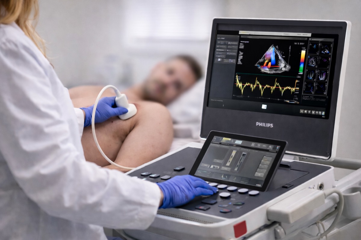 A cardiac sonographer holding an ultrasound probe against a patient's chest, with the ultrasound machine beside them.